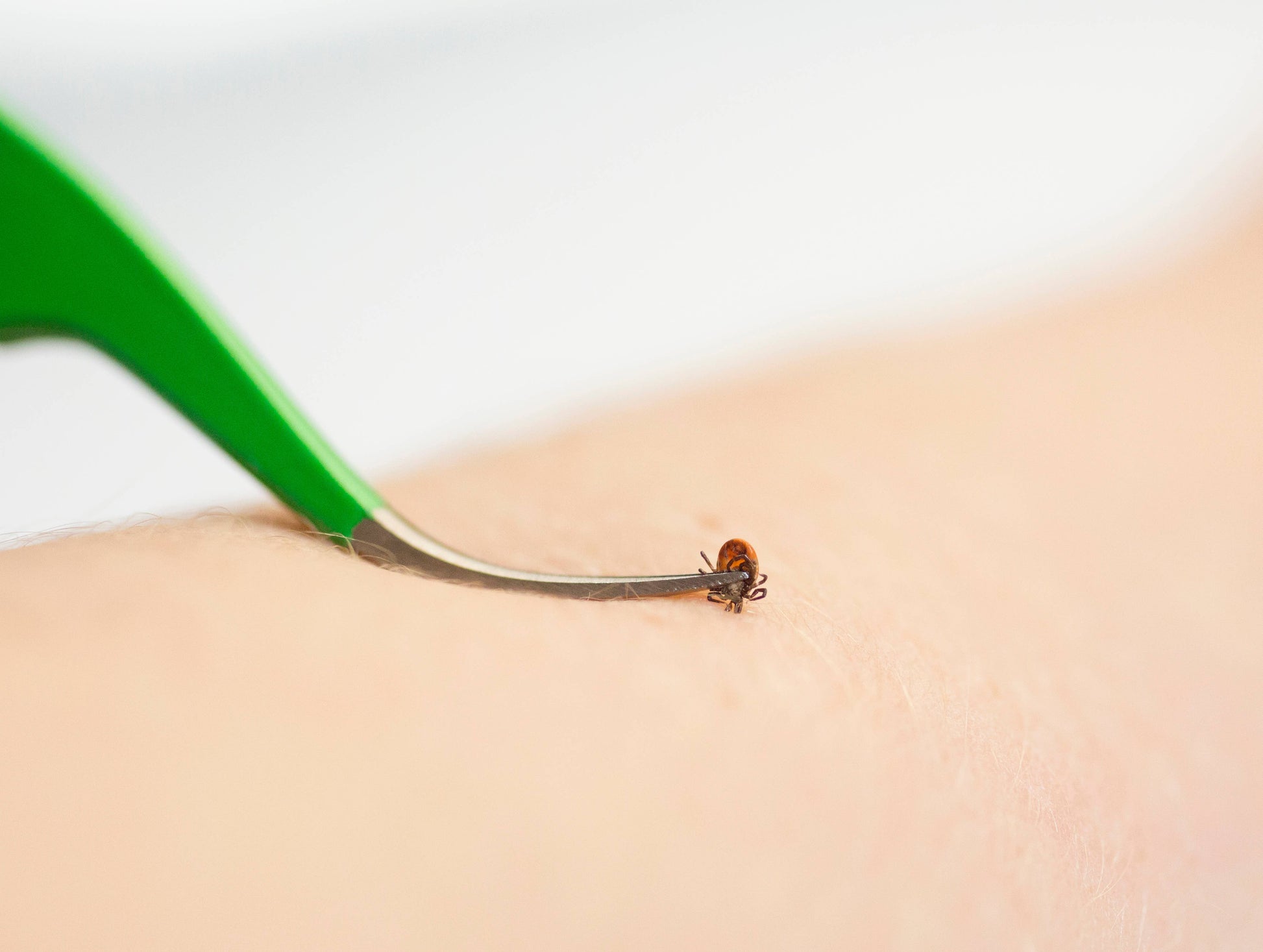 TickCheck Premium Tick Remover Kit - Mellow Monkey